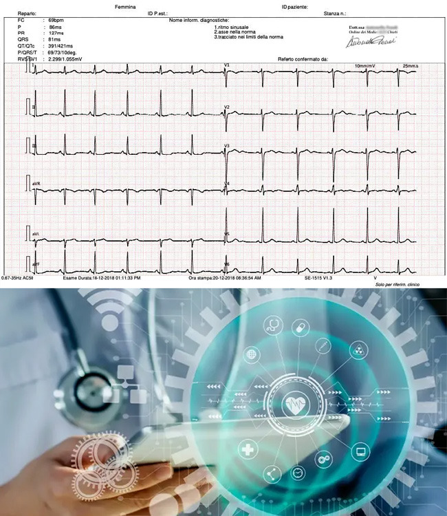 Elettrocardiogramma Veloce 15' con Referto da Medico Specialista